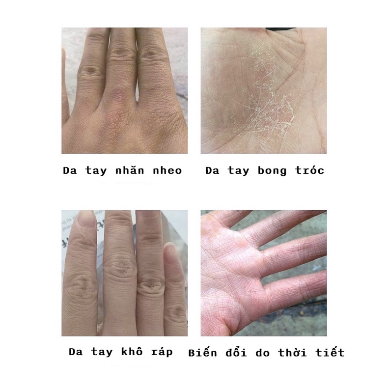 Serum YINBA Dưỡng trắng làm mềm da tay cao cấp