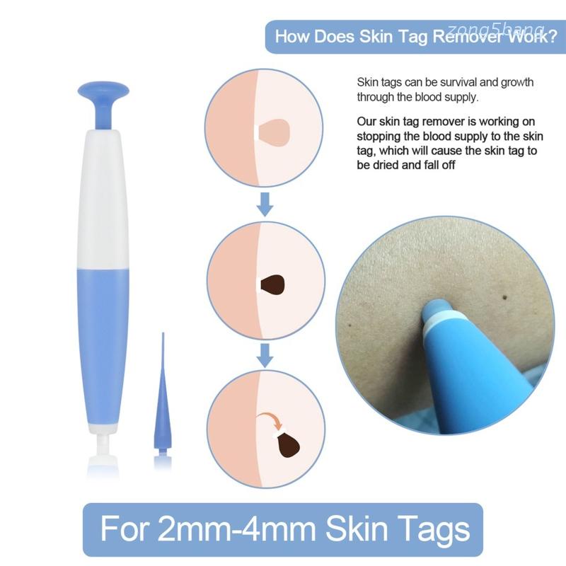 Bộ Dụng Cụ Loại Bỏ Thịt Dư Trên Da Không Đau Tiện Lợi