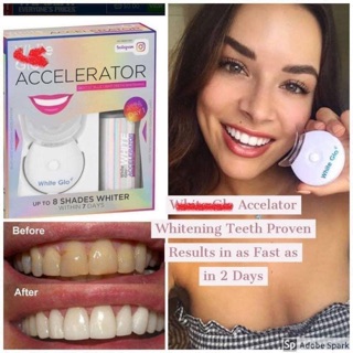 Bộ làm trắng răng White Glo Accelerator