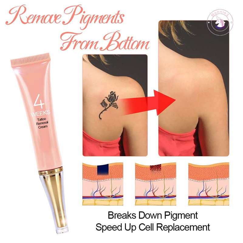 Kem Xóa Hình Xăm Vĩnh Viễn Không Cần Đau Cho Loại Bỏ Hình Xăm