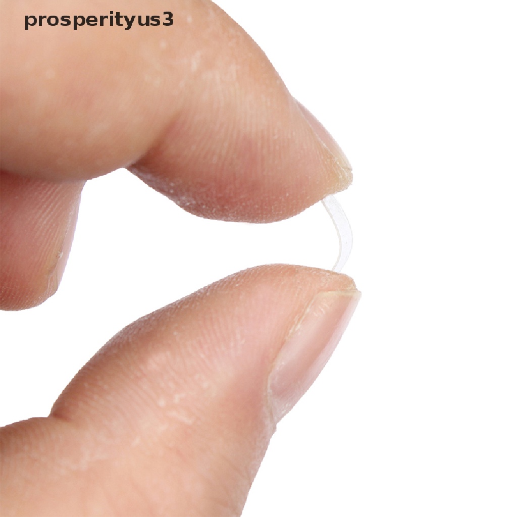 [prosperityus3] Ingrown Toenail Correction Tool Toe Nail Treatment Elastic Patch Sticker Clip [new]