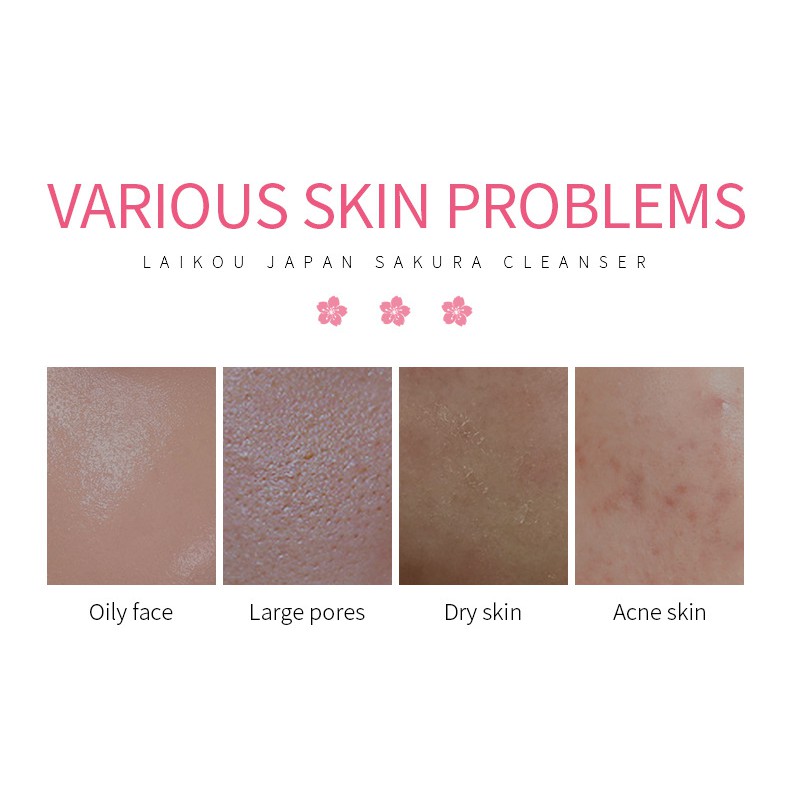 0203 B2 Sữa Rửa Mặt Tạo Bọt Hoa Anh Đào Laikou Japan Sakura Cleanser Làm Sạch Sâu Dịu Nhẹ Cho Da