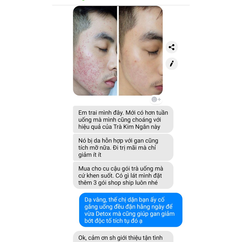 ✅[CHÍNH HÃNG] Trà Detox Hoa Kim Ngân Thải Độc Gan, Thanh Nhiệt, Trị Mụn Nhọt 100g (Loại Đẹp)💖 | BigBuy360 - bigbuy360.vn