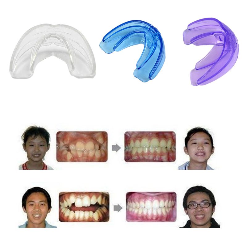 [Hàng mới về] Dụng cụ niềng răng chuyên nghiệp cho người lớn