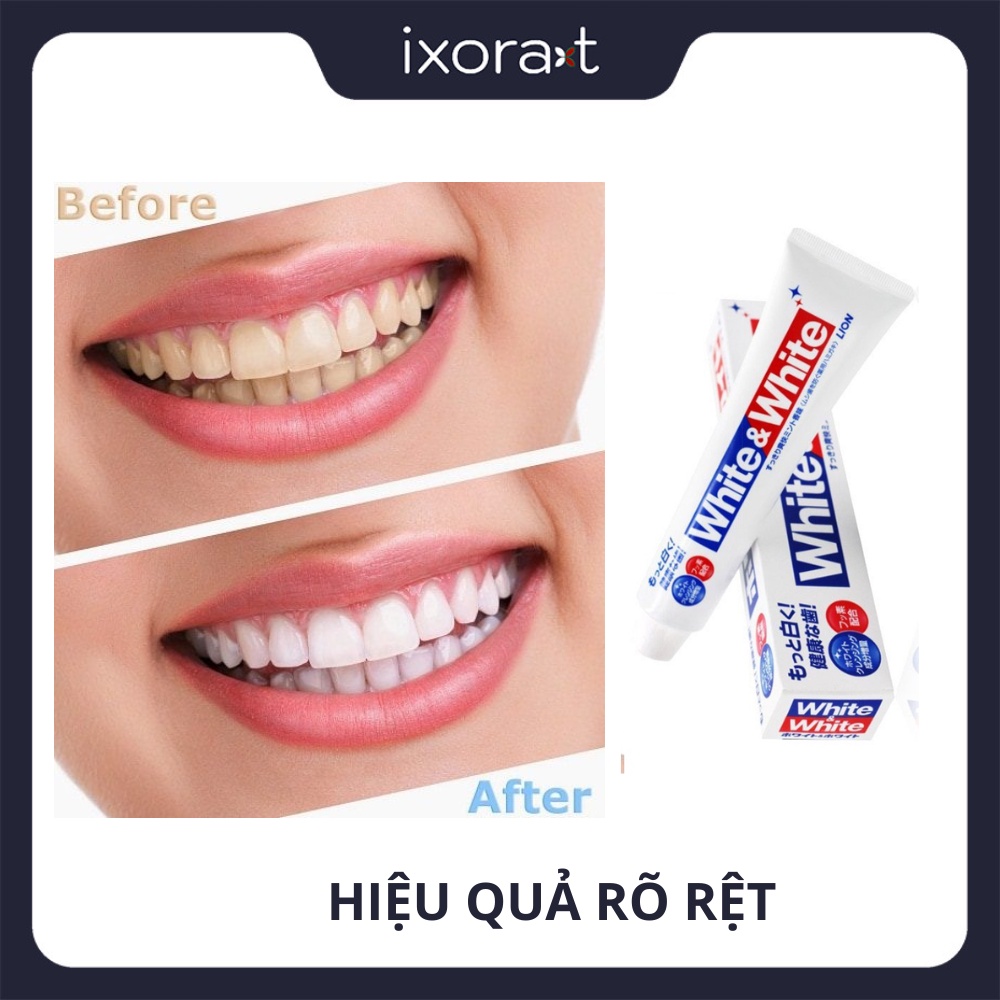 Kem Đánh Răng White & White Nhật Bản Lion 150g - Hỗ trợ làm trắng răng và ngăn ngừa sâu răng