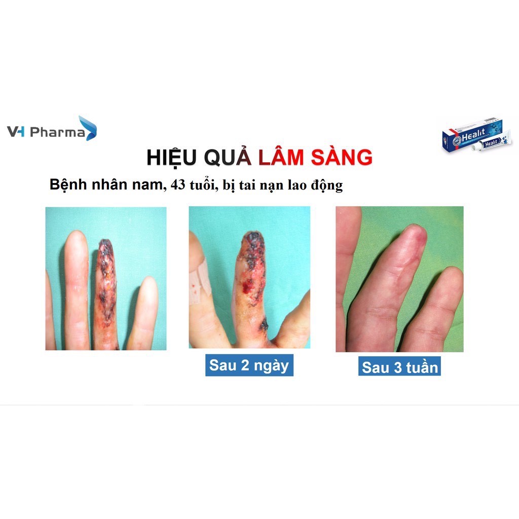 Healit gel - Gel bôi vết thương hở cấp và mạn tính