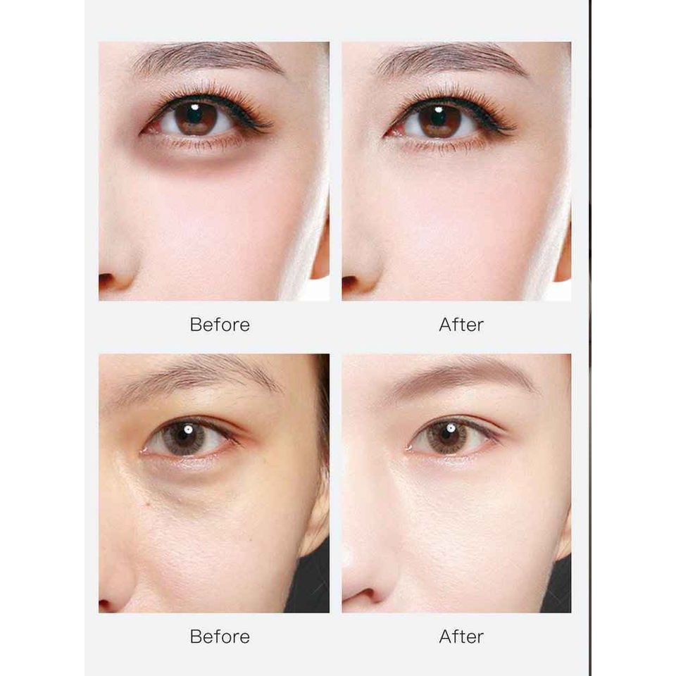 Kem Dưỡng Mắt Tích Hợp Máy Rung Massage JOMTAM Giảm Quầng Thâm Bọng Mắt | BigBuy360 - bigbuy360.vn