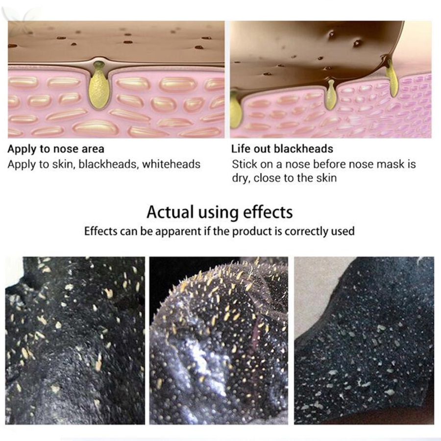 Mặt Nạ collagen Ốc Sên Lột Mụn Đầu Đen Làm Sạch Sâu Dưỡng Ẩm Làm Trắng Da Kiềm Dầu 120ml