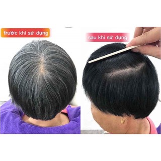 Nhuộm phủ bạc đen tóc collagen