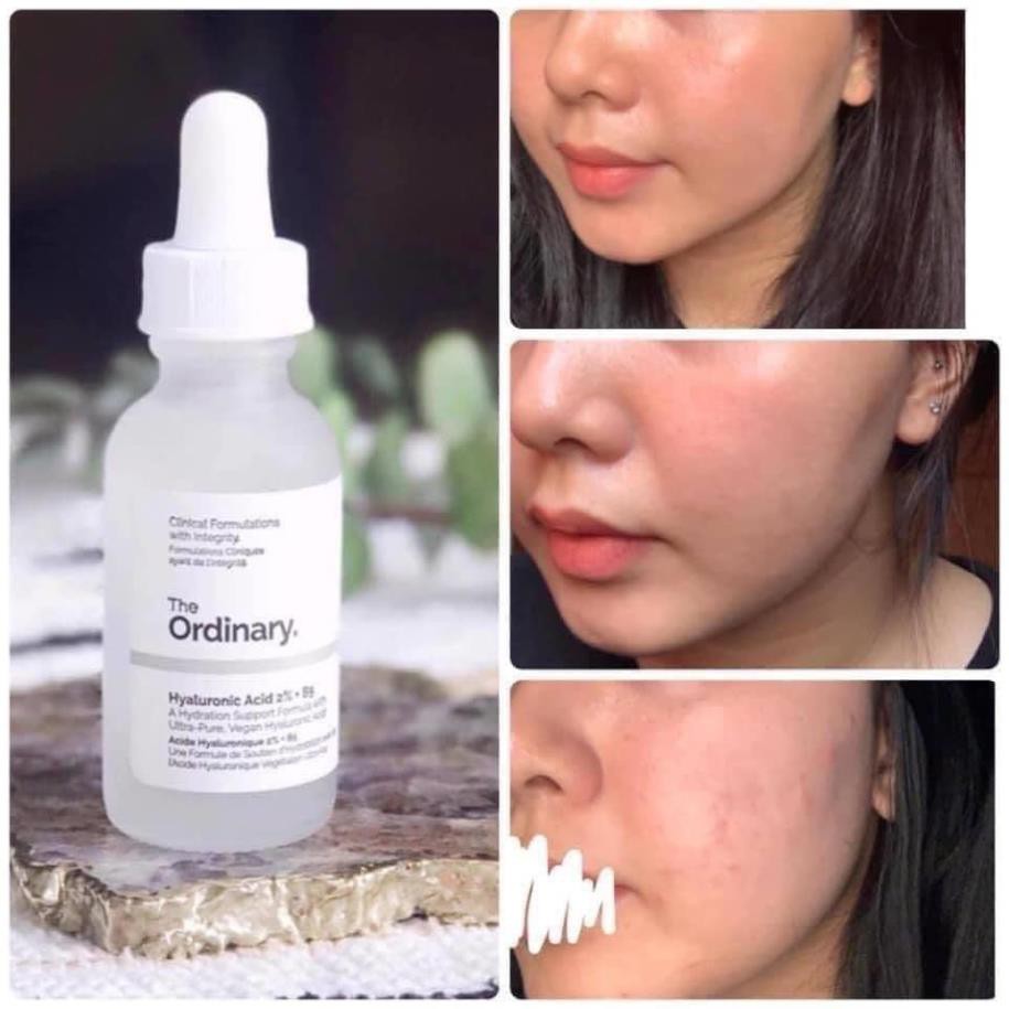 Serum The Ordinary - Hyaluronic Acid 2% + B5 Cấp Nước Dưỡng Ẩm