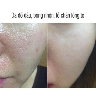 Tinh chất serum 𝐈𝐍𝐒𝐓𝐀𝐍𝐓 𝐏𝐎𝐑𝐄 𝐑𝐄𝐅𝐈𝐍𝐄𝐑 𝐙.𝐎 𝐒𝐊𝐈𝐍 dưỡng trắng mịn