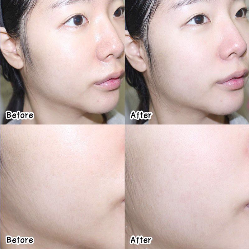 Sữa Rửa Mặt Cho Da Dầu Mụn, Nhạy Cảm - La Roche-Posay Effaclar Purifying Foaming Gel | BigBuy360 - bigbuy360.vn