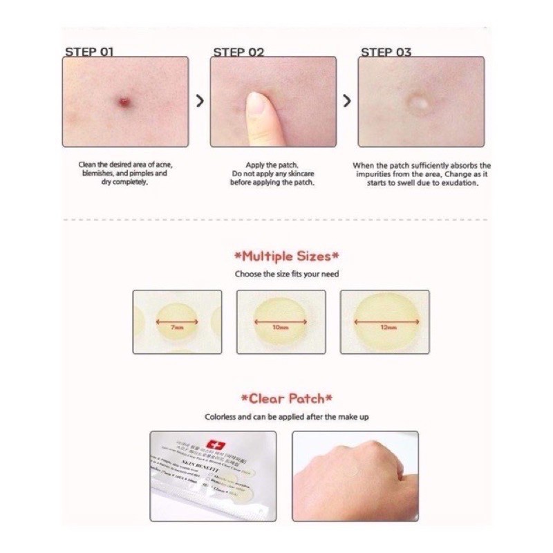 Miếng dán mụn Cosrx Acens Pimple Master Patch 24 miếng - hàng chính hãng