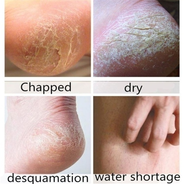 Set 2 chiếc vớ silicon bảo vệ gót chân