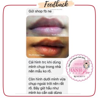 Serum Mờ Thâm Mắt - Môi Handmade