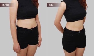 KEM TAN MỠ BỤNG MISSHA HOT BURNING