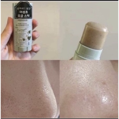 [AUTH] THANH LĂN MỤN ĐẦU ĐEN MAMONDE MẪU MỚI NHẤT 2018