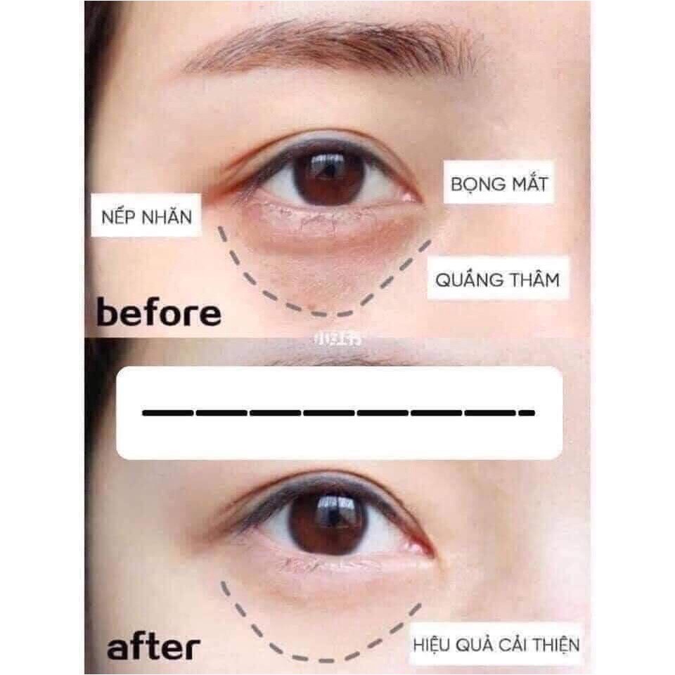 [săn sale, bill Hàn] Set kem mắt Ngày + Đêm Charmzone | BigBuy360 - bigbuy360.vn