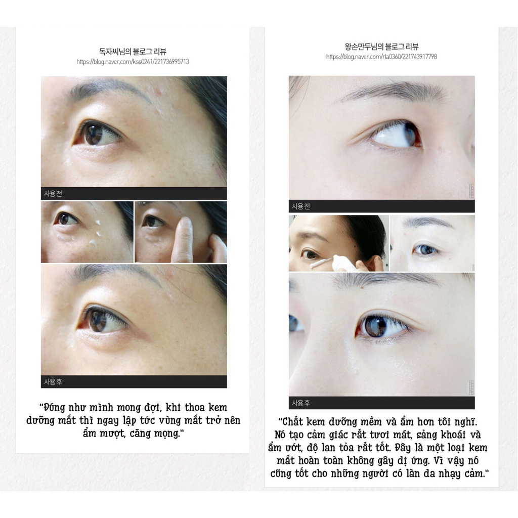 Kem dưỡng mắt giảm thâm bọng chống lão hóa Care:Nel Peptided Max Rescue Eye Cream