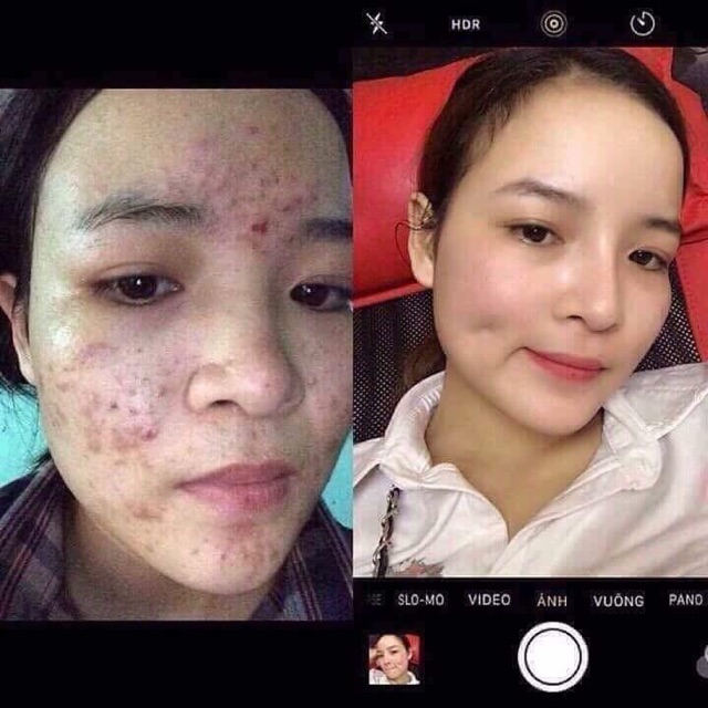 Serum đường đen Black sugar(khẳng định hiệu quả hơn mẫu caramel hồng nhé) KHÔNG HIỆU QUẢ HOÀN TIỀN | BigBuy360 - bigbuy360.vn