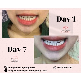 Miếng dán trắng răng Crest Supreme Professional (Trắng rất nhanh) - Combo 7 gói