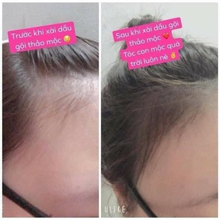 Xịt Bưởi Bạc Hà Tinh Chất Kích Mọc Tóc( Đảm Bảo Mọc Tóc)