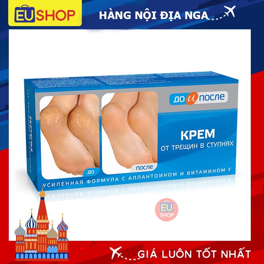 Kem nứt gót chân KPEM Nga Tuýp 50ml