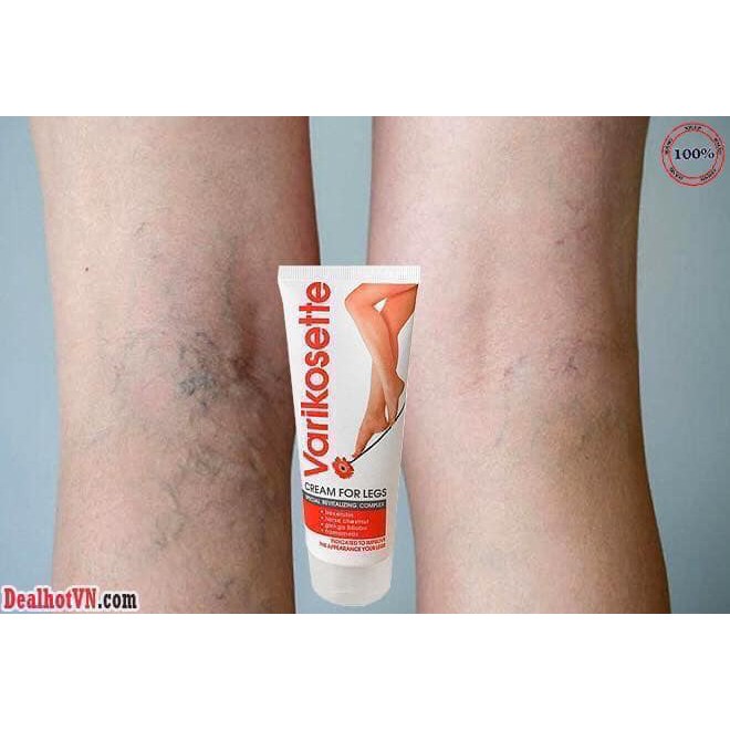 Kem Trị Suy Giãn Tĩnh Mạch Varikosette của Nga