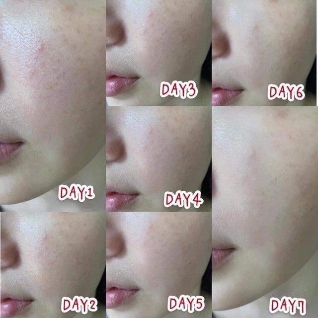 Serum Dr.Wu mandelic acid 18% 8% Đài Loan