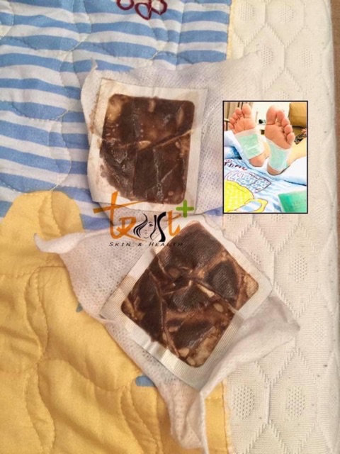 MIẾNG DÁN THẢI ĐỘC GANG BÀN CHÂN KENKO NHẬT BẢN | BigBuy360 - bigbuy360.vn