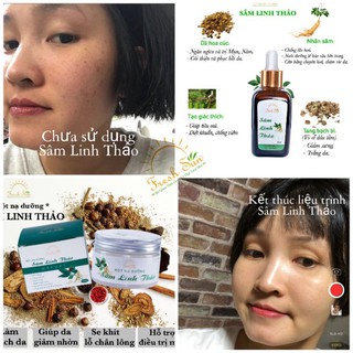 (Không Vỏ hộp) Bột nạ thảo dược Sâm Linh Thảo