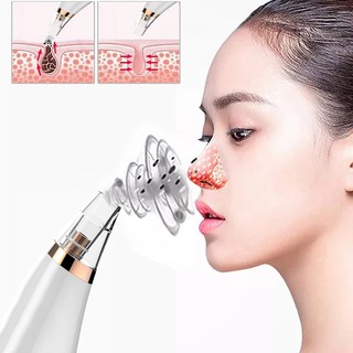 Máy hút mụn cầm tay, hút mụn cám, mụn đầu đen cao cấp ba đầu hút