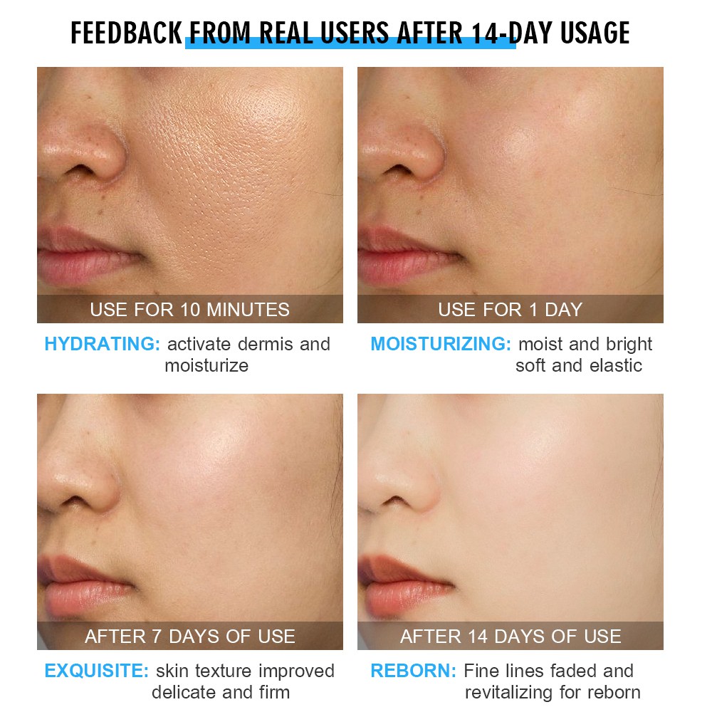 Serum VIBRANT GLAMOUR Chiết Xuất Axit Hyaluronic Giữ Ẩm Giảm Mụn Và Nếp Nhăn Làm Trắng Thu Nhỏ Lỗ Chân Lông 30ml | BigBuy360 - bigbuy360.vn