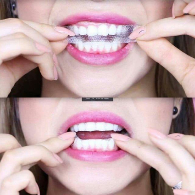 Miếng dán trắng răng 1 Hour Express Whitestrips