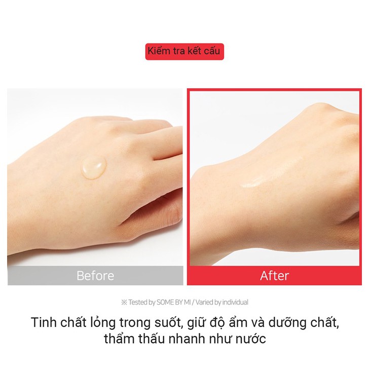 Tinh chất ốc sên đen giảm sẹo lõm - sẹo mụn Some By Mi Snail Truecica Miracle Serum 50ml