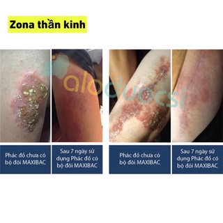 Xịt kháng khuẩn Maxibac ( bộ đôi xịt + gel maxibac)