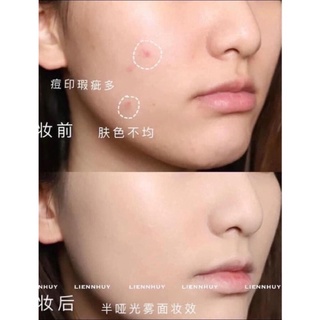 𝙆𝙀𝙈 𝙉𝙀̂̀𝙉 𝘿𝙄0𝙍 𝙎𝙆𝙄𝙉 𝙉𝙐𝘿𝙀 𝘼𝙄𝙍 tone trung bình dùng mix nền sáng