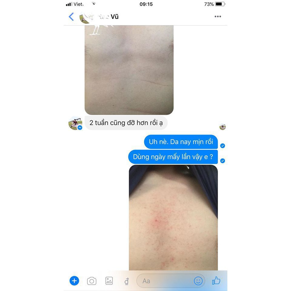 MEN VI SINH TAVIDA HẾT MỤN LƯNG, VIÊM NANG LÔNG, MẨN NGỨA | BigBuy360 - bigbuy360.vn