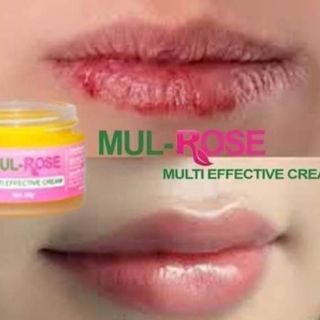 Kem đa năng mul rose