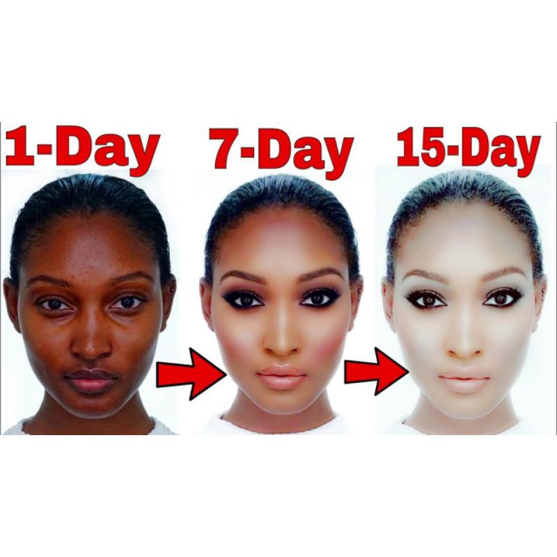 Hoạt chất trắng da L-Glutathanone