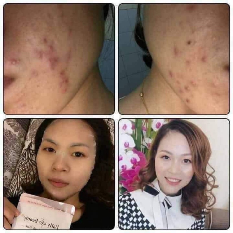 MẶT NẠ NHAU THAI CỪU R&B DAILY BEAUTY