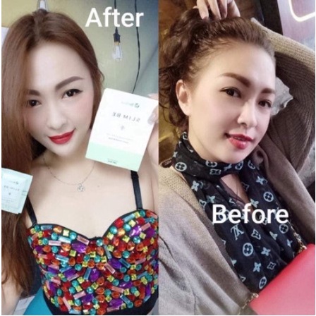 Trà Giảm Cân BeAlive Slim Be Hộp 30 Viên Kiểm Soát Cân Nặng Giảm Cân Cấp Tốc An Toàn Cải Thiện Số Đo 3 Vòng