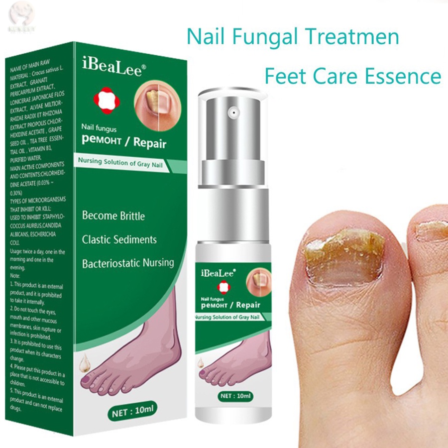 Tinh Chất Hỗ Trợ Giảm Bệnh Nấm Móng Kháng Khuẩn Nuôi Dưỡng Làm Sáng Móng Tay / Chân / Móng Chân TTLIFE