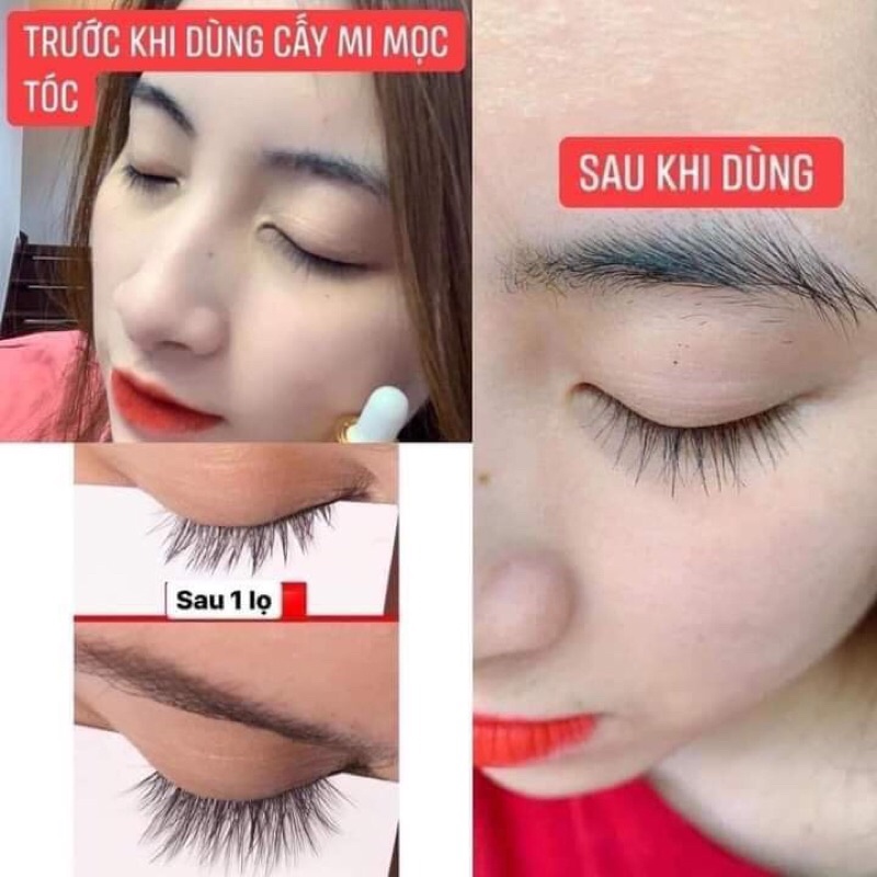 SIÊU PHẨM CẤY MI-MỌC TÓC DR.HAIR