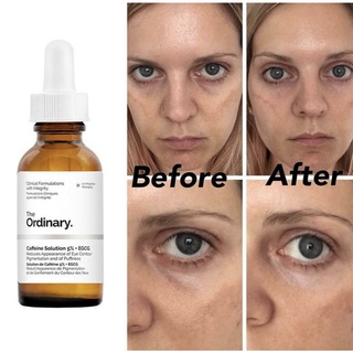 ( BILL CANADA ) Serum mắt Caffeine Solution 5% + EGCG - The Ordinary
