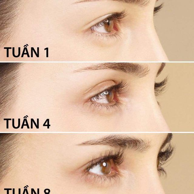 Huyết thanh dưỡng mi Eveline Lash Therapy Professional 8in1 Total Action