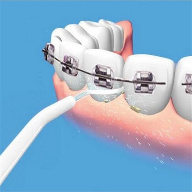 Máy Xịt Nước Cầm Tay Vệ Sinh Răng Miệng