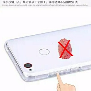Ốp Nubia Z17
