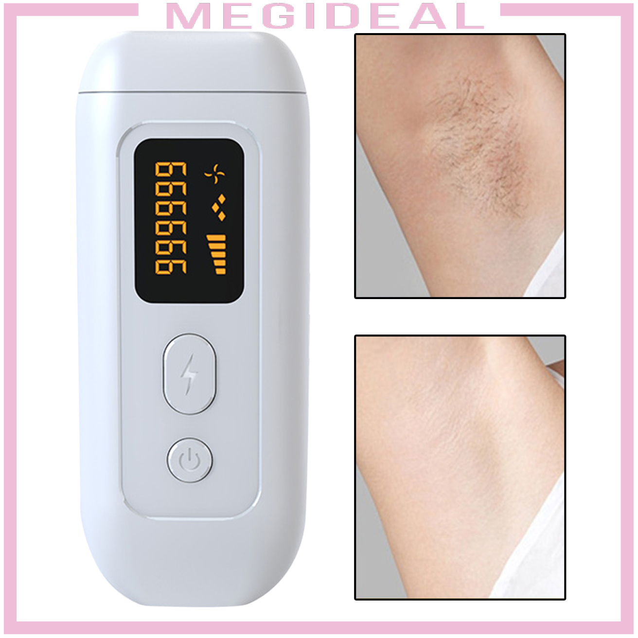 (Hàng Mới Về) Máy Cạo Lông Vĩnh Viễn Bằng Laser 990000 Flashes Phích Cắm Eu | BigBuy360 - bigbuy360.vn