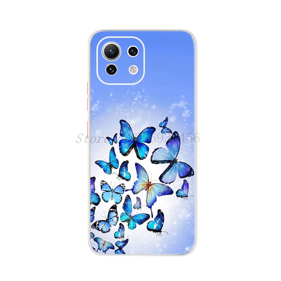 Ốp Điện Thoại Mềm Viền Khung Cho Xiaomi Mi 11 Lite 5G Mi11 Lite 4G 5G Funda Coque Xiomi 11 Lite NE 5G